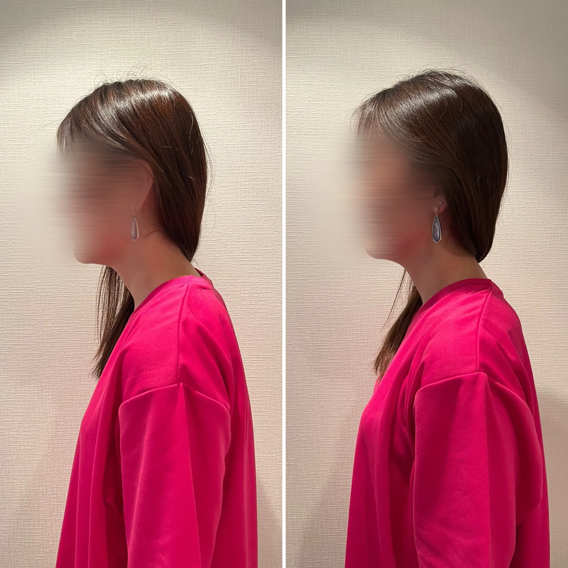 姿勢の悪さ、全身の倦怠感 30代・女性